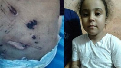 مفاجأة .. تقرير الطب الشرعي يؤكد عدم تعرض جنه وشقيقتها للاغتصاب