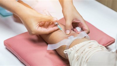 اختبار دم جديد يكشف سرطان القولون