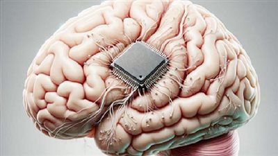 دراسة تختبر شريحة دماغية تمكّن مرضى الشلل من التحكم في الأجهزة