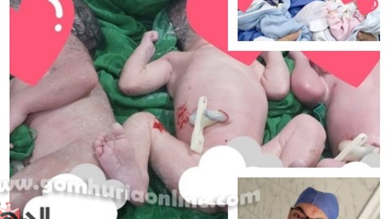 نجاح ولادة 3 توائم