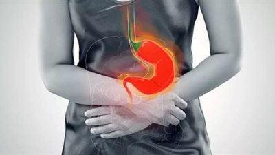3 نصائح لتجنب الحموضة وارتجاع المريء