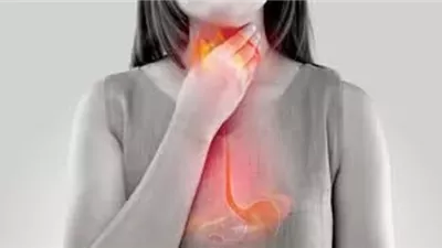 10 نصائح للوقاية من ارتجاع المريء