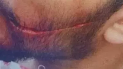 الشرقية: استبعاد مدير مدرسة وإيقاف قيد طالب إثر اعتداء بمشرط