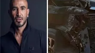 تطورات الحالة الصحية لـ أحمد سعد بعد الحادث
