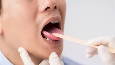 علامات في الفم قد تكشف أمراضاً خطيرة .. طبيبة أسنان توضح