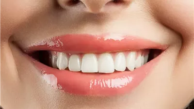 العناية بالأسنان في المنزل.. نصائح عملية للحفاظ على ابتسامة صحية