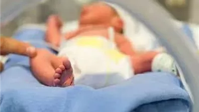 دراسة: الولادة المبكرة تقلل خطر تسمم الحمل