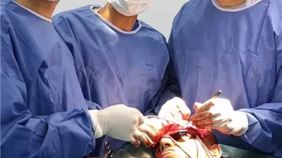 نجاح جراحة إصلاح كسور معقدة بالوجه ومحجر العين بمستشفى السنبلاوين