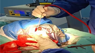 باستخدام جراحات اليقظة نجاح جراحة مخ وأعصاب دقيقة بالدقهلية