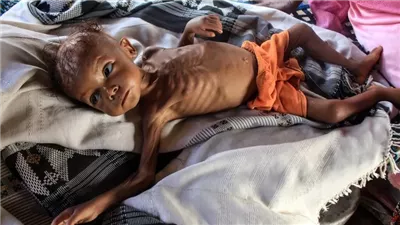 21 مليون سوداني يعانون نقصا حادا في الغذاء