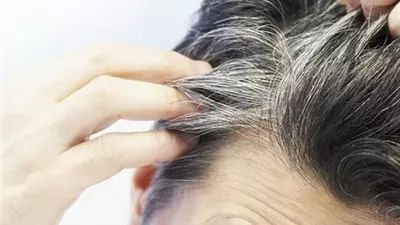 باحثون يتوصلون إلى علاج طبيعي لشيب الشعر