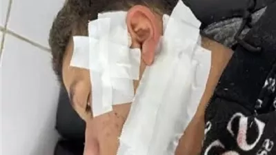 نيابة الزقازيق تأمر بضبط طالب ثانوي طعن زميله بعد لجنة الامتحانات