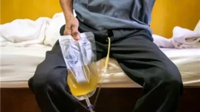 الإفتاء توضح كيفية تطهر مريض القسطرة وحكم صلاته