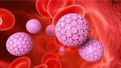 لماذا يُعد فيروس HPV تهديدًا خفيًا قد ينتهي بالسرطان؟