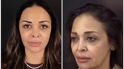 داليا البحيري تخضع لعملية جراحية لشد الوجه والرقبة والجفون