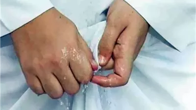 حكم صلاة من رأى نجاسة على ثوبه بعد الانتهاء من الصلاة