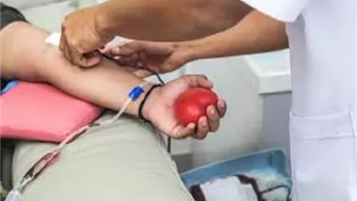 حكم الحجامة ونقل الدم أثناء الصيام