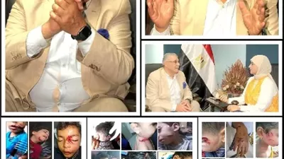 اللواء مدحت الحريشى لـ«بوابة الجمهورية»: الكلاب الضالة قنابل بيولوجية موقوتة