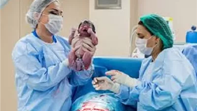 سجلت نحو 80 % خلال 2025 حكم الولادة القيصرية عند طبيب رجل