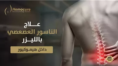 علاج أمراض الشرج بالليزر: دليل شامل عن الناسور الشرجي والناسور العصعصي