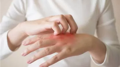 خبراء يوضحون أحدث طرق علاج الحساسية وتقليل نوباتها