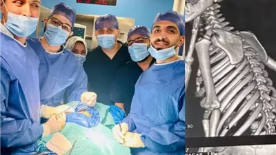 إنقاذ طفل من الموت بمعجزة داخل مستشفيات جامعة بنها بعد اختراق مفك لرقبته
