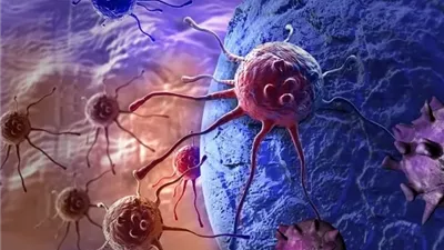 ثورة في علاج السرطان .. الطب يقترب من السيطرة على المرض