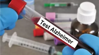 فحص دم جديد قد يكتشف الزهايمر مبكرًا بدقة تصل إلى 91%