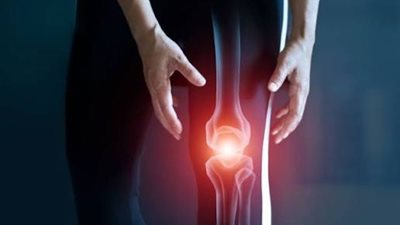 دراسة .. تناول الكحول يرتبط بارتفاع خطر الإصابة بالفصال العظمي