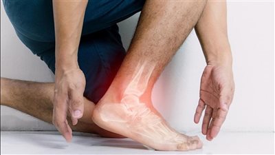 علامات تظهر في الساقين قد تنذر بارتفاع الكوليسترول وتضيق الشرايين