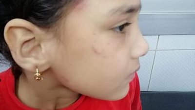 أم الطفلة جنة الجديدة : كويتها بالنار لنقلها أخباري لأهل زوجي المحبوس..صور