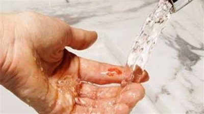 منها الخل.. طرق طبيعية لعلاج الحروق في المنزل