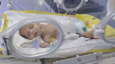 عملية جراحية لطفل عمره 53 يوما بدار إيواء كفرصقر..صور