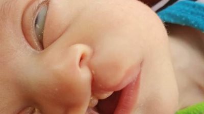 بالفيديو دنيا إبنة الإسماعيلية تستغيث بالرئيس ورئيس الوزراء لعلاج طفلتها من تضخم القلب والرئة