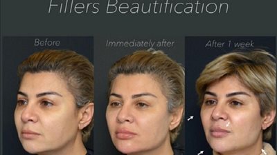 شاهد... إعلامية شهيرة تخضع لعملية 