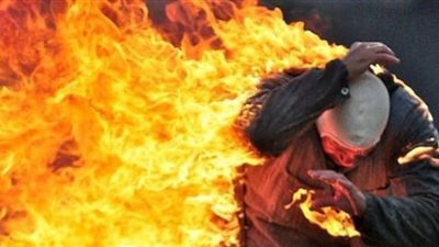 عامل يشعل النيران في نفسه احتجاجًا على تنفيذ قرار إزالة