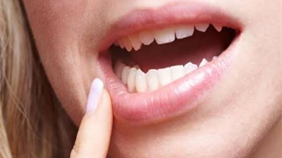 اسباب تورم اللثة وعلاجها بأكياس الشاي