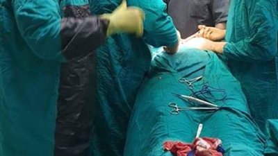 إستئصال مرارة لسيدة بعد تجهيزها وعلاجها من كسل وظائف الكبد بمستشفي دهب المركزي