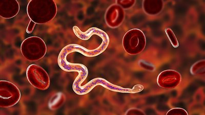 لدغات بعوض تحول قدم رجل الى 5 أضعاف حجمها