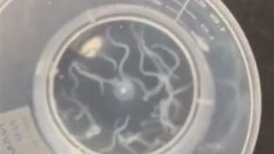 لمالكى الحيوانات الأليفة ...حالة مرضية لرجل صينى تدق ناقوس الخطر