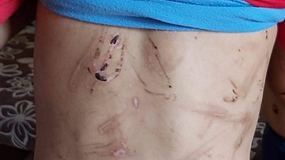 حبس زوج الأم المتهم بتعذيب أولاد زوجته بقليوب 15 يوم علي ذمة التحقيقات