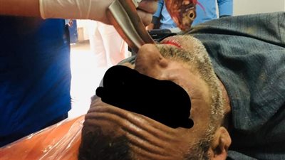 انقاذ صياد أبتلع سمكه حيه فى بنى سويف