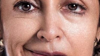 عرض جديد ظاهر فى الوجه يكشف عن كورونا يصاحبه حدة فى السمع