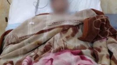 إجراء جراحة عاجلة وحرجة لإنقاذ حياة شاب مصاب بطعن نافذ بالصدر والقلب بمستشفي الزقازيق العام