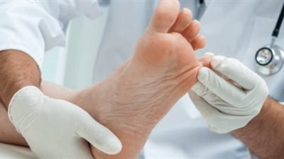 أسباب الإصابة بفطريات القدم والأظافر ونصائح لمكافحتها