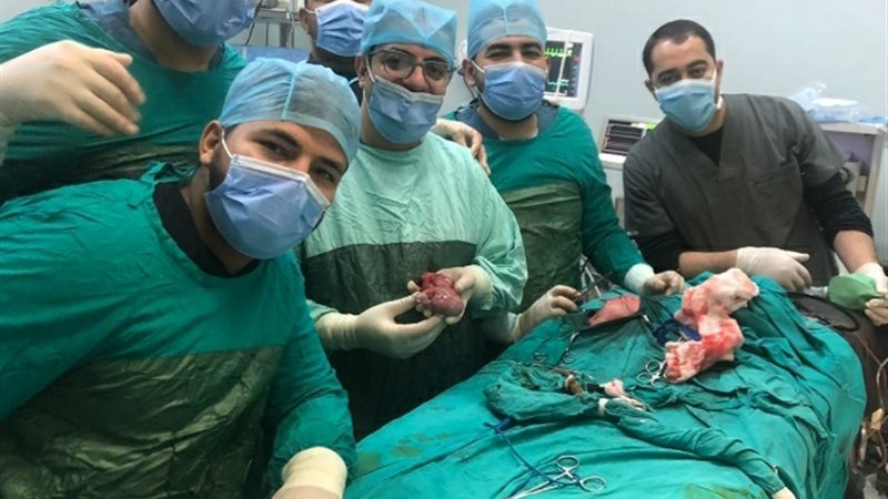 جراحة نادرة بمستشفيات