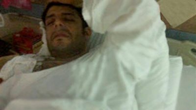 إصابة محمد حماقي في مباراة لكرة القدم ... صور