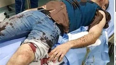 كلبان مفترسان يمزقان ضابط شرطة بالقاهرة الجديدة