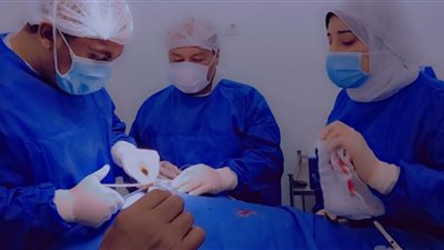إجراء عملية جراحية ناجحة بالمخ لطفل لأول مرة بمستشفى السنبلاوين العام