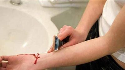 قطعت يدها طمعاً فى أموال التأمينات.. فسجنت 5 سنوات بتهمة الاحتيال
